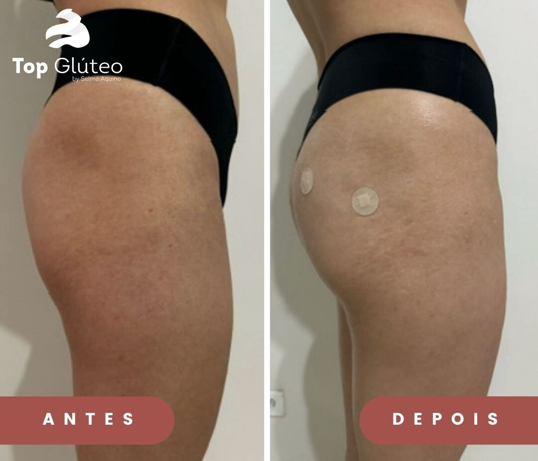 Resultado 3